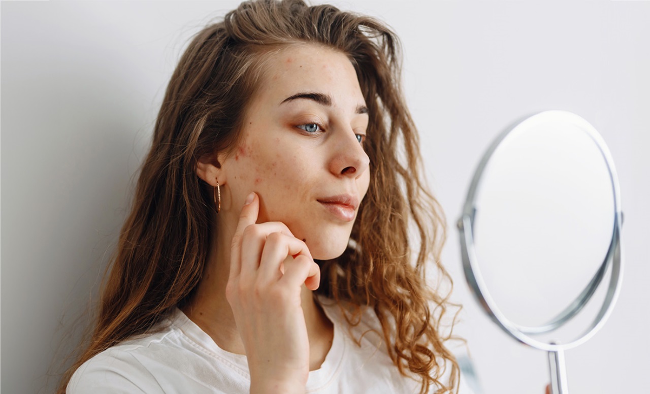 चेहरे के दाग-धब्बों से